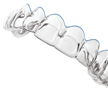 Suresmile clear aligners